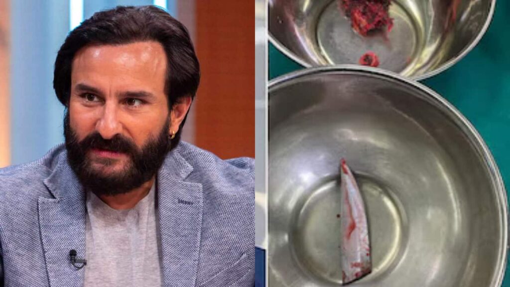 Saif Ali Khan attack: Image of knife lodged in actor’s spine surfaces online, see first pic